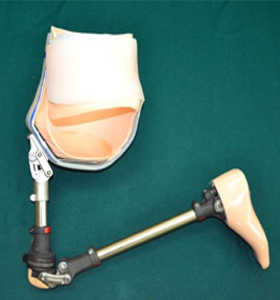 disarticulaion